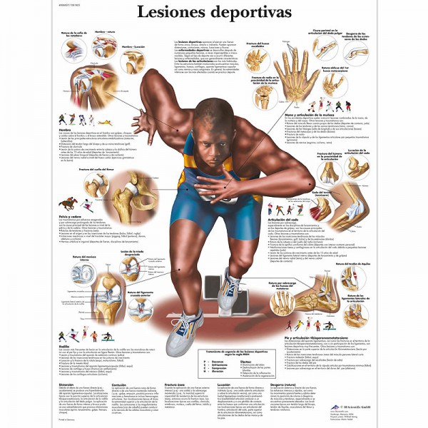 Lámina de anatomía: Lesiones deportivas