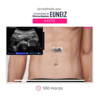 CAMPUS WAZO: Curso Online de Ecografía Abdominal. Certificado universitario oficial emitido por la Universidad de Vitoria-Gasteiz (EUNEIZ) CAMPUS WAZO: Curso Online de Ecografía Abdominal. Certificado universitario oficial emitido por la Universidad de Vitoria-Gasteiz (EUNEIZ)