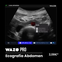 Software de Simulación Clínica en Ecografía Abdominal: Suscripción Anual WAZO® PRO Software de Simulación Clínica en Ecografía Abdominal: Suscripción Anual WAZO® PRO