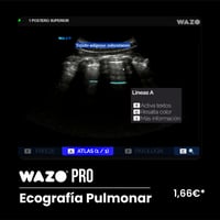Software de Simulación Clínica en Ecografía Pulmonar: Suscripción Anual WAZO® PRO - Pulmonar y Pleural Software de Simulación Clínica en Ecografía Pulmonar: Suscripción Anual WAZO® PRO - Pulmonar y Pleural