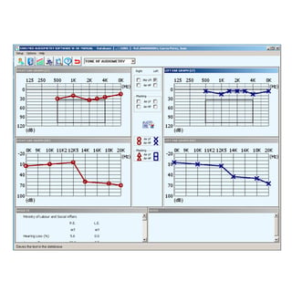 Software Sibelmed W5O para audiómetro Sibelmed 400