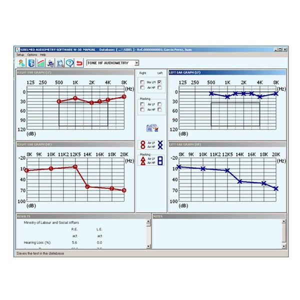 Software Sibelmed W5O para audiómetro Sibelmed 400