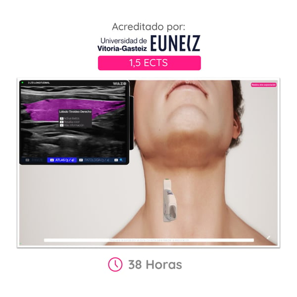 CAMPUS WAZO: Curso Online de Ecografía Cervical en Cuello y Tiroides. Certificado universitario oficial emitido por la Universidad de Vitoria-Gasteiz (EUNEIZ)