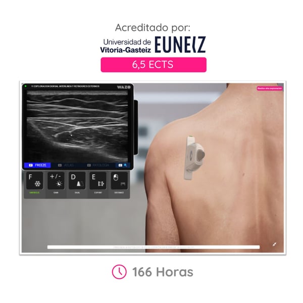 CAMPUS WAZO: Curso Online de Musculoesquelética. Certificado universitario oficial emitido por la Universidad de Vitoria-Gasteiz (EUNEIZ)
