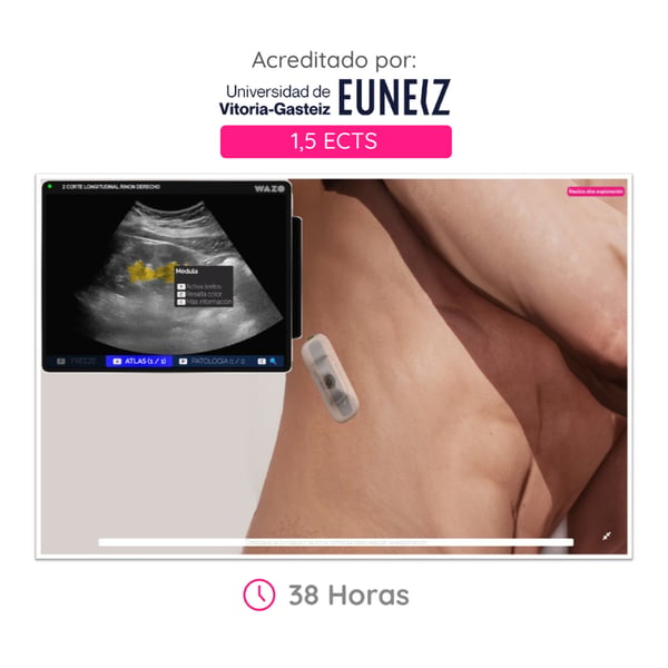 CAMPUS WAZO: Curso Online de Ecografía Urológica. Certificado universitario oficial emitido por la Universidad de Vitoria-Gasteiz (EUNEIZ)