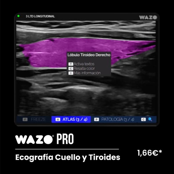 Software de Simulación Clínica en Ecografía Cervical: Suscripción Anual WAZO® PRO - Cuello & Tiroides