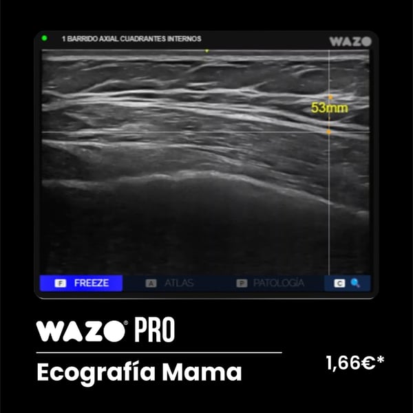 Software de Simulación Clínica en Ecografía Mamaria: Suscripción Anual WAZO® PRO - Mama