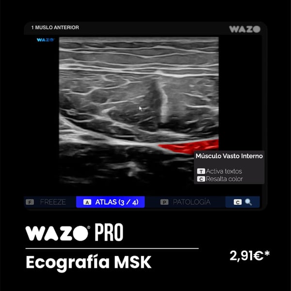 Software de Simulación Clínica en Ecografía Musculoesquelética: Suscripción Anual WAZO® PRO - MSK