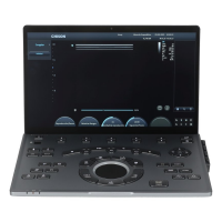 Ecógrafo Portátil Chison SonoAir 70 Ecógrafo Portátil Chison SonoAir 70