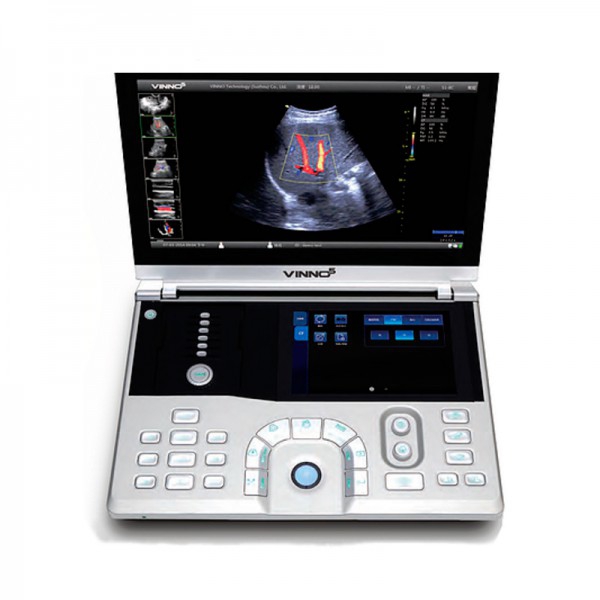 Ecógrafo Vinno 5 para Ginecología y Obstetricia (3D/4D) - Pack 2