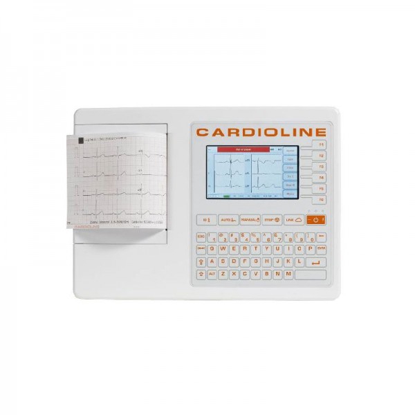 Electrocardiógrafo Cardioline ECG 100s: un avanzado electrocardiógrafo de 12 derivaciones
