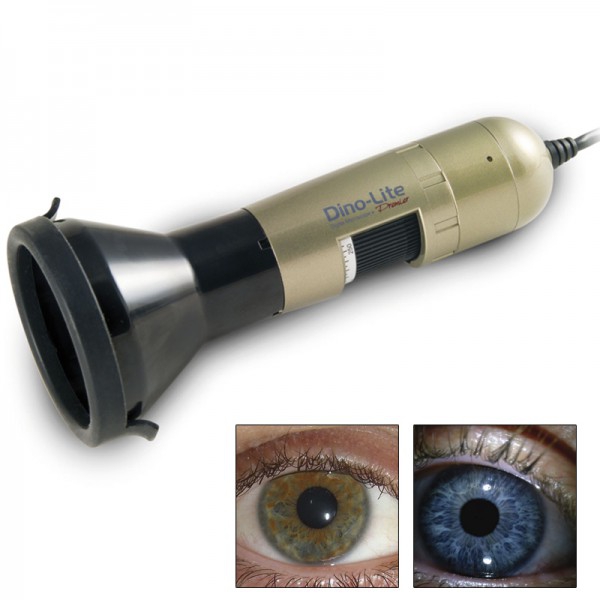 Iriscopio Dino-Lite: Permite crear fácilmente imágenes nítidas de los ojos y los iris Iriscopio Dino-Lite: Permite crear fácilmente imágenes nítidas de los ojos y los iris