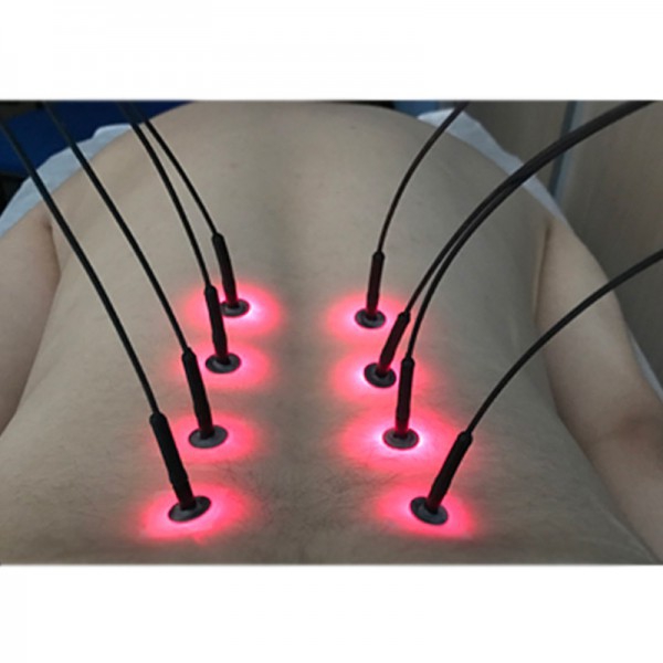 Sistema de Aguja de Luz Light Needle 8 Fibras: Convierte 1 láser en 8 puntos de salida a la vez Sistema de Aguja de Luz Light Needle 8 Fibras: Convierte 1 láser en 8 puntos de salida a la vez