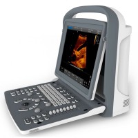 Ecógrafo Portátil Chison ECO2 Ecógrafo Portátil Chison ECO2
