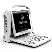 Ecógrafo portátil Chison ECO3 Expert Ecógrafo portátil Chison ECO3 Expert