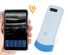 Ecógrafos SonoStar Ecógrafos SonoStar