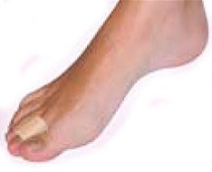 Protecciones y plantillas de silicona y gel Protecciones y plantillas de silicona y gel