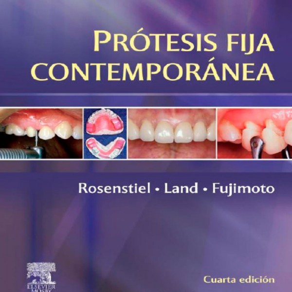 Prótesis Fija Contemporánea  ¡ÚLTIMA UNIDAD! Prótesis Fija Contemporánea  ¡ÚLTIMA UNIDAD!