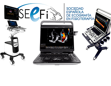 Curso de Ecografía Músculo-Esquelética para Fisioterapeutas (Madrid - Sede Fisaude: 7, 8 y 9 Febrero)